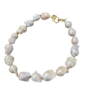 Baroque Pearls on Colorful Thread Choker | 15.5"